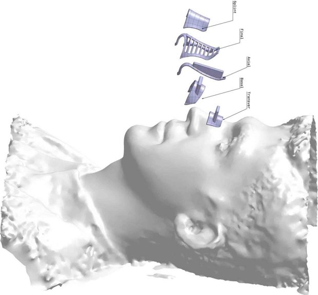 دهه سوم زندگی، شایع ترین سن جراحی زیبایی بینی