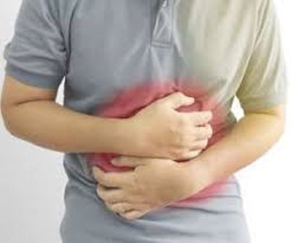 مصرف قلیان و سیگار عوامل شایع رفلاکس معده