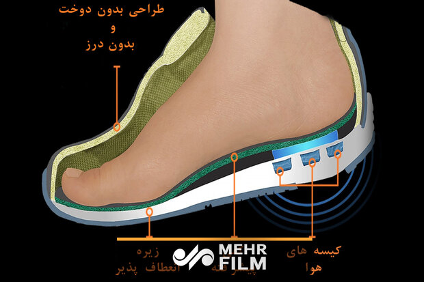 کفش مناسب بیماران دیابتی چیست؟